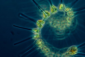 Carbons under a microscope