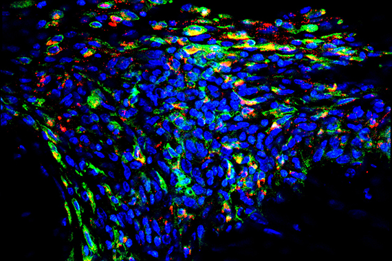 Blue, green, yellow, and red nanoparticles illuminate a muscle tendon.