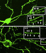 green fluorescent neurons