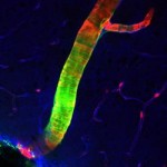 New Scientist: Waste Disposal Network Discovered in the Brain New Scientist: Waste Disposal Network Discovered in the Brain