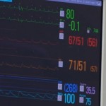 Small Defibrillator Tweaks Give Big Benefits Small Defibrillator Tweaks Give Big Benefits