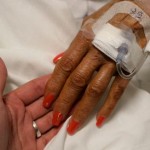 Study Aims to Curtail Chemo Queasiness Study Aims to Curtail Chemo Queasiness