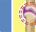 Orthopaedists Connect Science, Common Health Burdens Orthopaedists Connect Science, Common Health Burdens