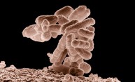 Superbugs May Have a Soft Spot Superbugs May Have a Soft Spot