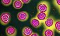 $3 million funds research to develop new HIV vaccine strategies $3 million funds research to develop new HIV vaccine strategies