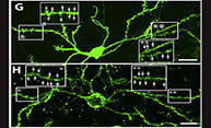 Brain Cells Lost to Huntington’s Disease Regenerated Brain Cells Lost to Huntington’s Disease Regenerated