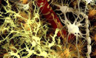Finding points to possible new Parkinson’s therapy Finding points to possible new Parkinson’s therapy