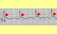 $2.9M grant enables fight vs. fatal heart disorders $2.9M grant enables fight vs. fatal heart disorders