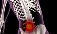 Commonly prescribed drug for lower back pain not effective Commonly prescribed drug for lower back pain not effective