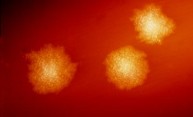 Inappropriate use of antibiotics biggest risk factor for C. diff infection Inappropriate use of antibiotics biggest risk factor for C. diff infection
