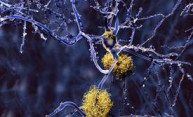 Study: Brain’s immune system could be harnessed to fight Alzheimer’s Study: Brain’s immune system could be harnessed to fight Alzheimer’s