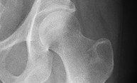 Quality, not quantity, of hospital time impacts hip fracture patients’ odds of survival Quality, not quantity, of hospital time impacts hip fracture patients’ odds of survival
