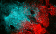 Scientists discover stem cells capable of repairing skull, face bones Scientists discover stem cells capable of repairing skull, face bones