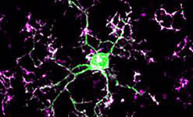 Immune cells ‘prune’ connections between neurons Immune cells ‘prune’ connections between neurons