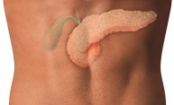 Experimental therapy shrinks pancreas tumors Experimental therapy shrinks pancreas tumors