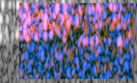 Breakthrough adds new color to ultrasound Breakthrough adds new color to ultrasound