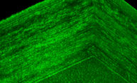 Researchers explore regeneration in critical layer of cornea Researchers explore regeneration in critical layer of cornea