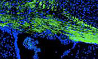 Repurposed drugs may offer improved treatments for fatal genetic disorders Repurposed drugs may offer improved treatments for fatal genetic disorders