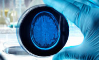 Grant will examine link between ‘dirty’ brains and Alzheimer’s Grant will examine link between ‘dirty’ brains and Alzheimer’s