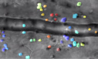 Imaging the secret lives of immune cells in the eye Imaging the secret lives of immune cells in the eye
