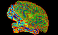 An experimental neurofeedback imaging treatment has emerged for psychiatric patients. Does it work? An experimental neurofeedback imaging treatment has emerged for psychiatric patients. Does it work?