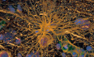 New grant will unlock workings of the brain’s waste removal system New grant will unlock workings of the brain’s waste removal system