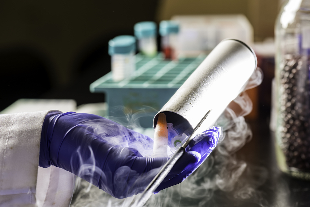 Cultures and samples are examined after being frozen in liquid nitrogen.