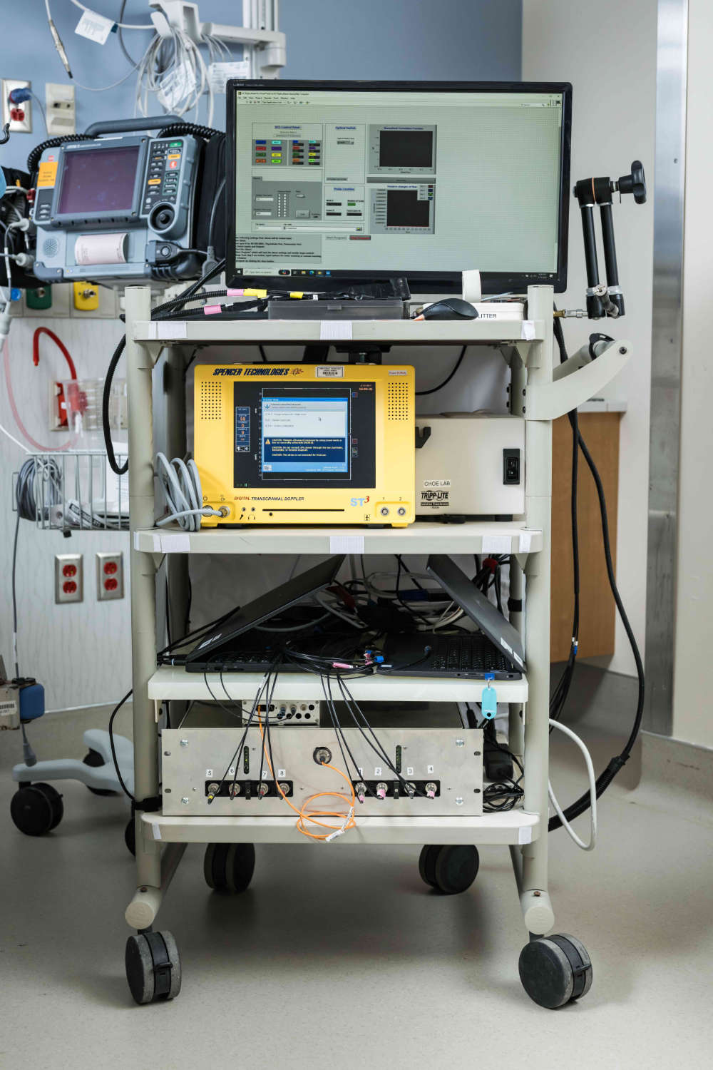 Prototype of ECMO machine with neuoromonitoring capabilities. 