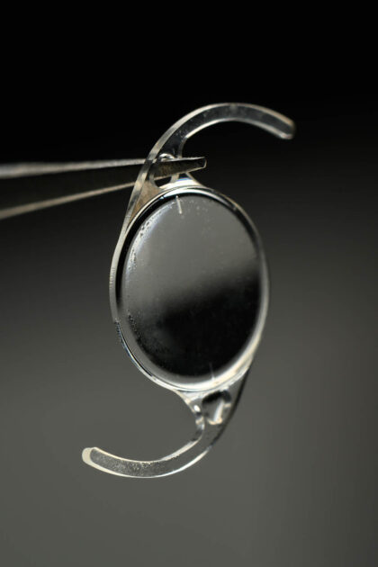 An intraocular lens suspended by a pair of tweezers. 