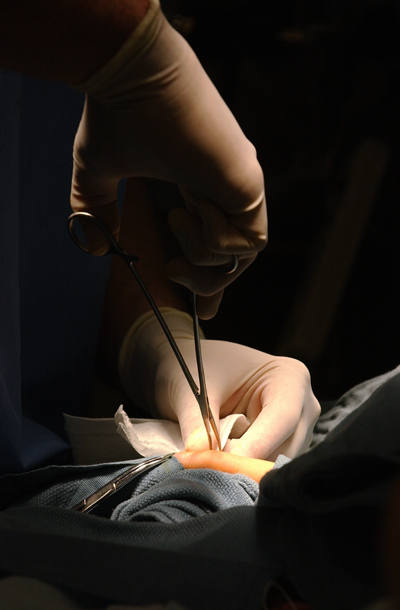 surgery