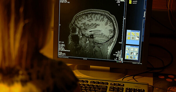 a female scientist examining a brain scan