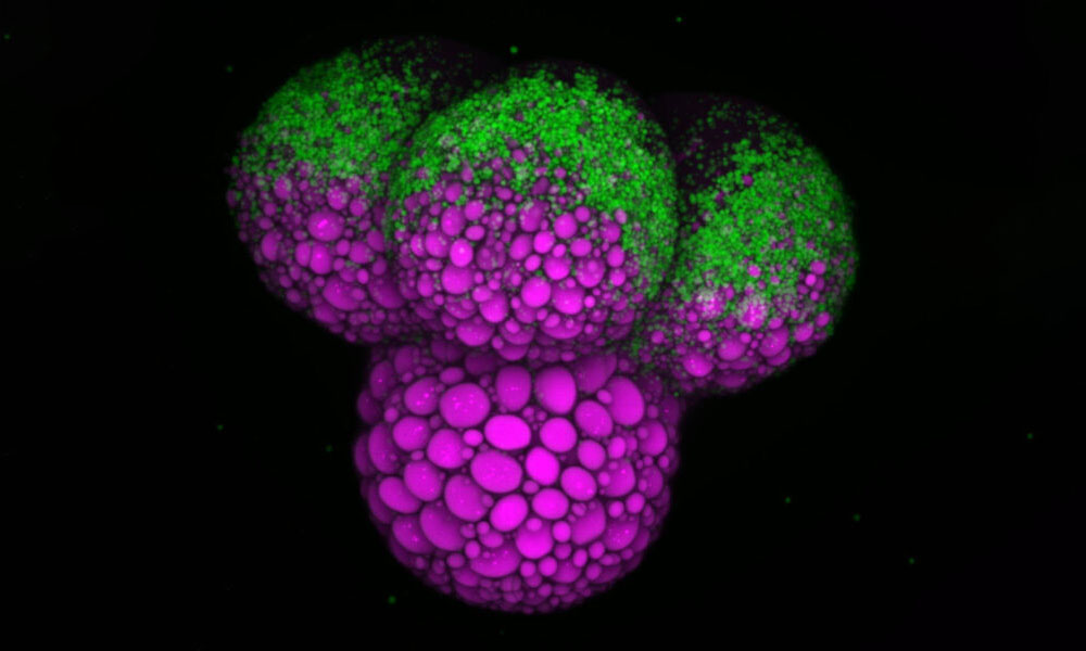 Nutrient segregation in a snail embryo with the magenta protein separated from the green fat.