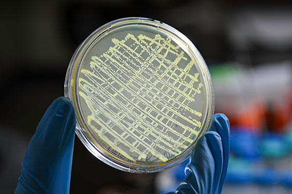 A gloved hand holds a petri dish of bacteria.