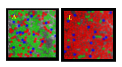 image of color cones in the eye