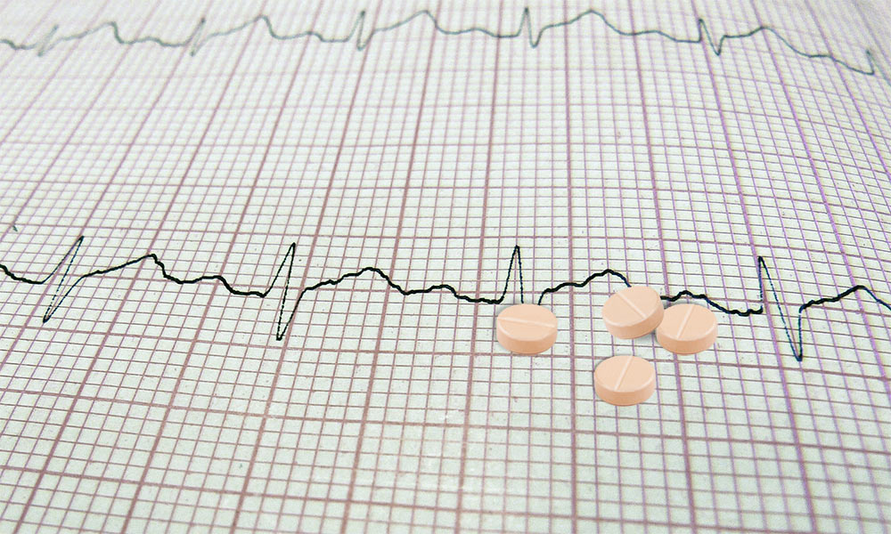 Baby aspirin? Many doctors don’t despite guidelines News