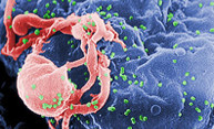 Researchers receive $3.4 million to study experimental HIV drug combo