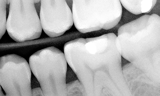 Feature image dental xray