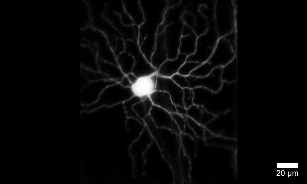 photo of cell, glowing with tendrils emanating from it