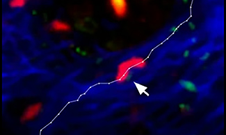 Feature image still from video shows immune cells working together