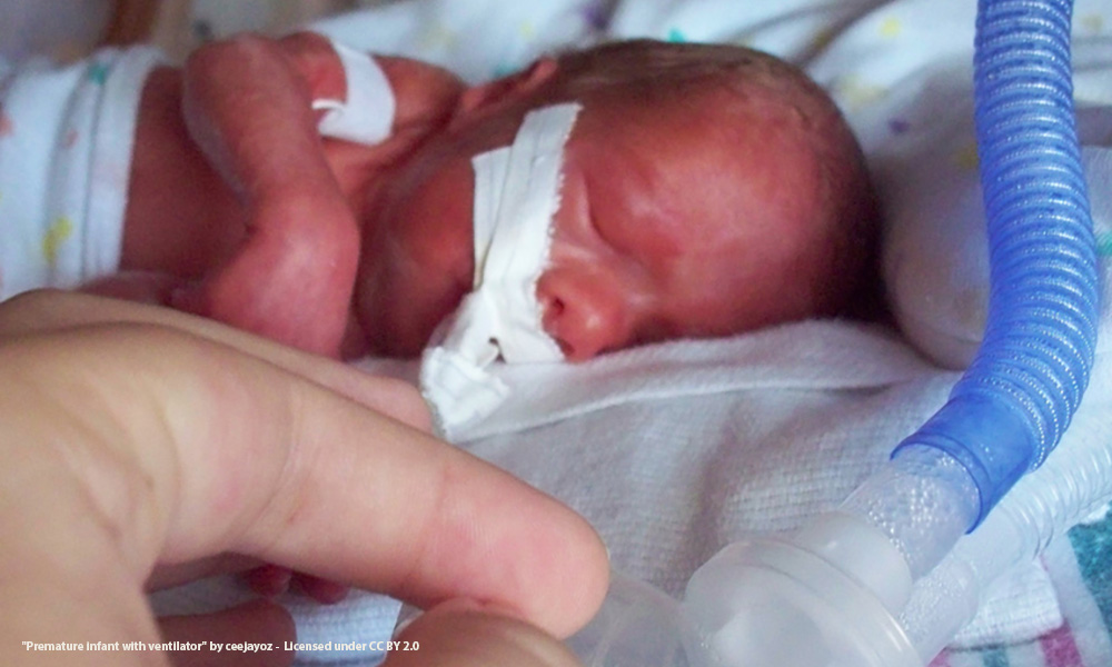 premature infant in incubator