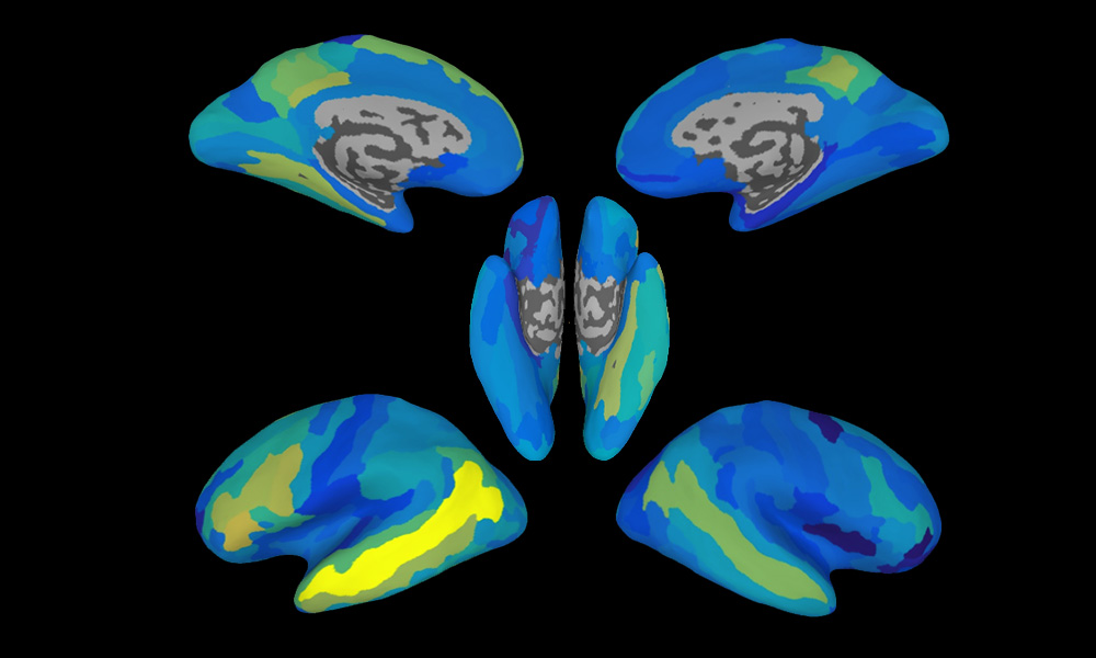 Feature image illustration of colored areas of the brain showing increased bairn activity