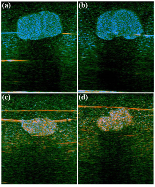 In these images from the lab of Professor Kevin Parker, an increase in fatty lipids in liver tissue (figures a and b) is shown in blue using the H-scan format, compared to normal tissue (figures c and d).