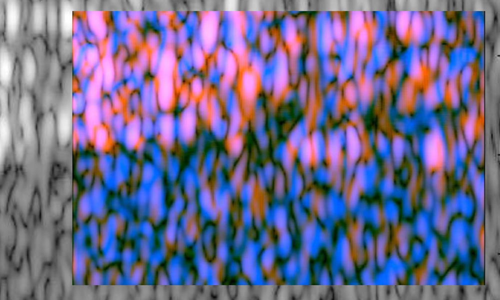 color and gray imaging from ultrasound