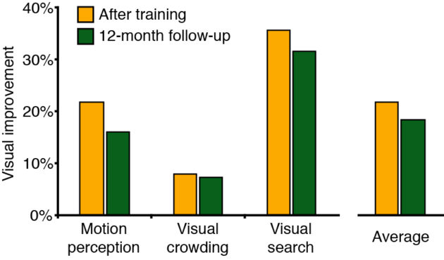 Brain training video games help improve kids vision