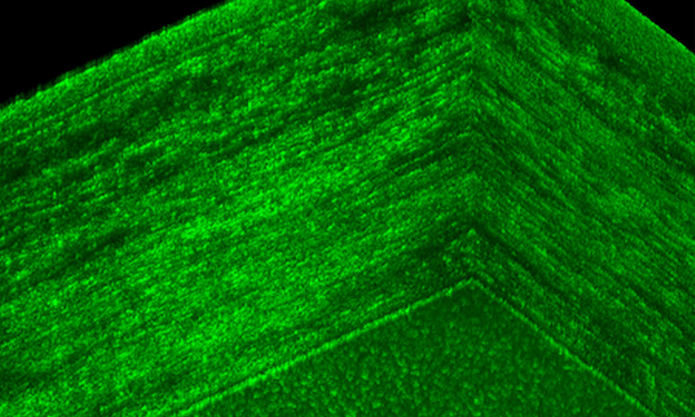 microscopic image of cornea