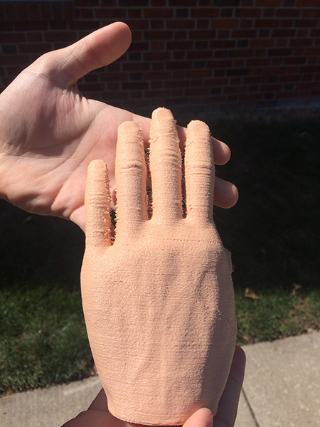 prosthetic hand
