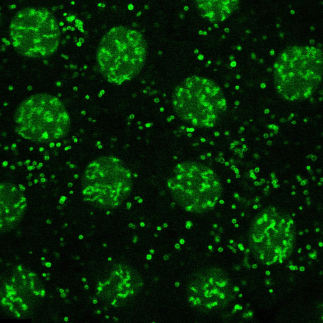 green fluorescent droplets seen at high magnification