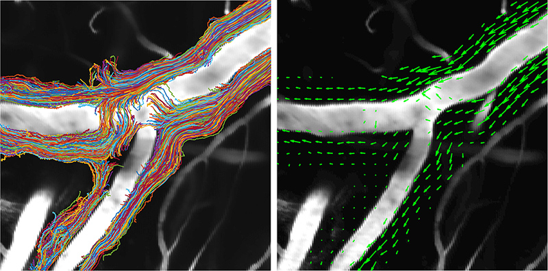 illustration of spinal fluid moving through perivascular spaces
