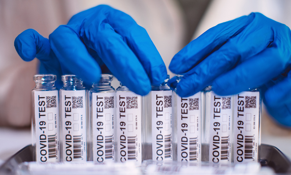 image of covid-19 test vials