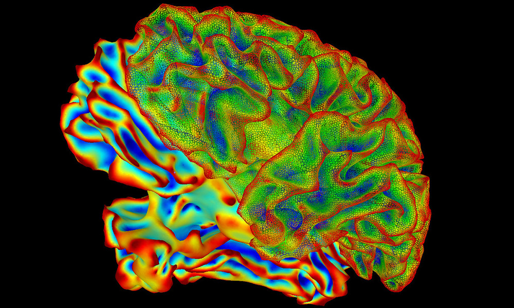 fMRI scan of the brain